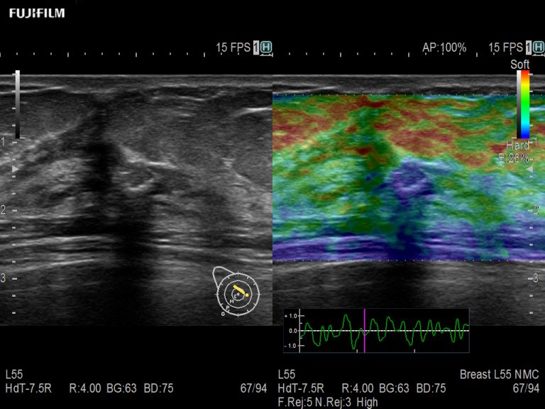 Radiology Ultrasound Arietta Fujifilm Healthcare