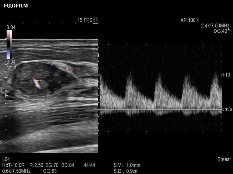 Radiology Ultrasound – ARIETTA 65 | Fujifilm Healthcare