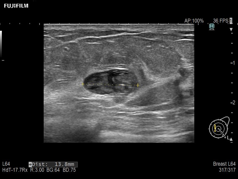 Radiology Ultrasound – ARIETTA 65 | Fujifilm Healthcare