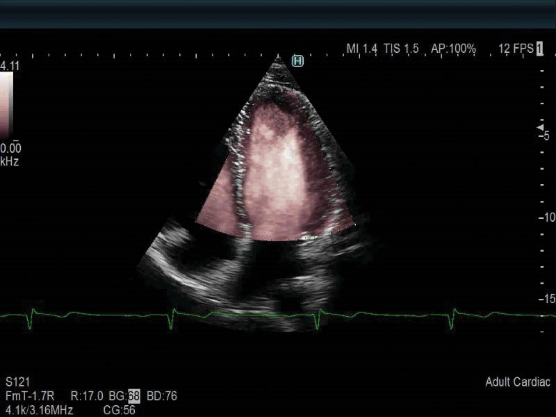 Heart 3D (12fps)