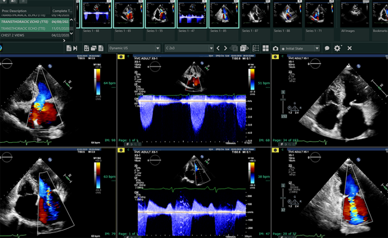 Cardiology PACS System - Quality Image | Fujifilm Healthcare