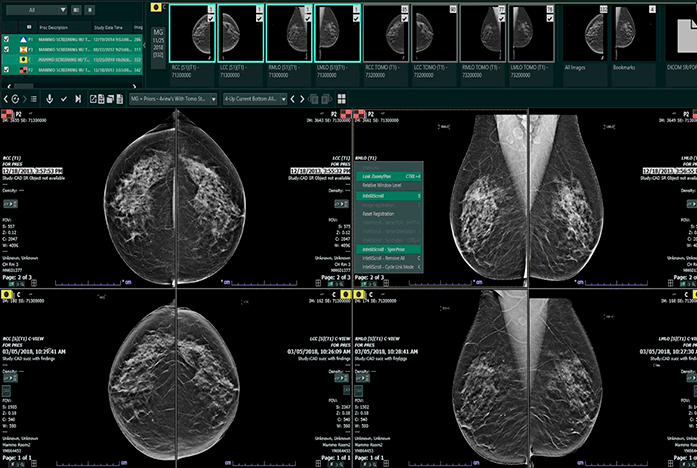 Radiology PACS System  Image Quality by Fujifilm Healthcare