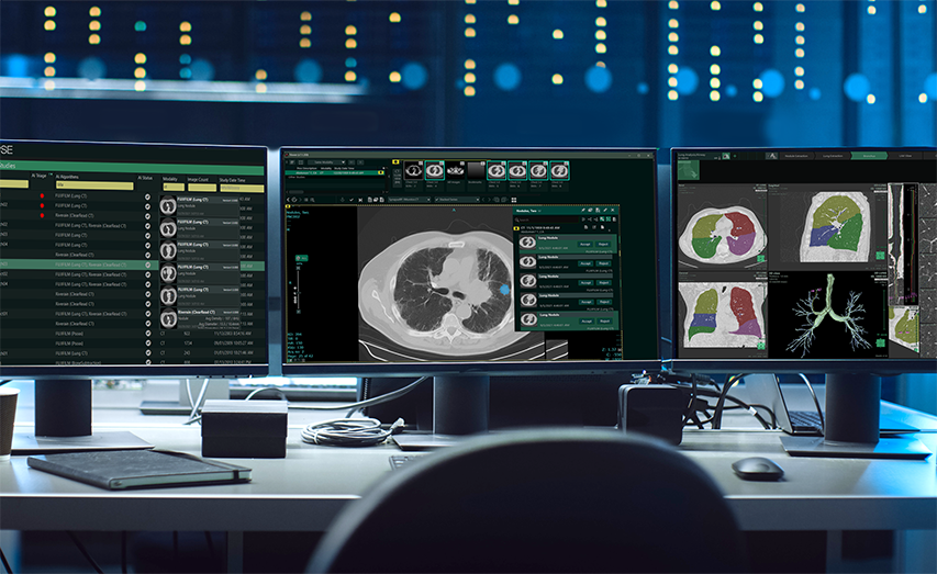 Radiology PACS System  Image Quality by Fujifilm Healthcare