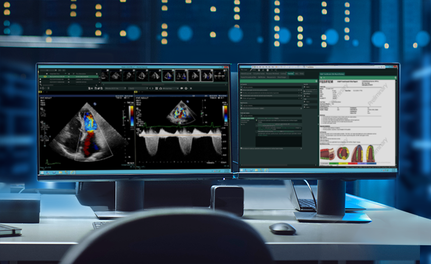 Radiology PACS System  Image Quality by Fujifilm Healthcare