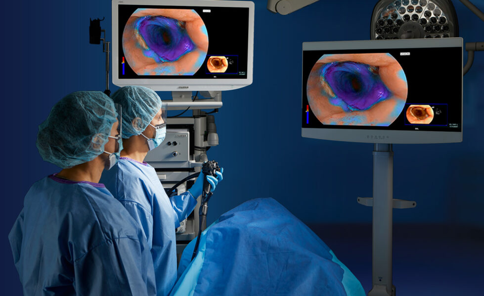 Endoscopic Imaging Solutions | Fujifilm Healthcare Solutions