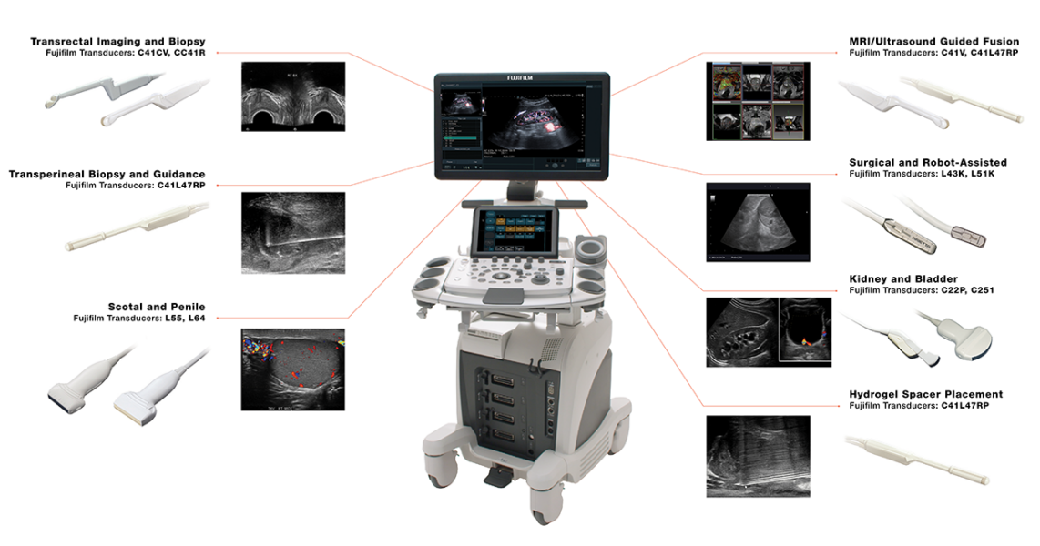 UROLOGY ARIETTA 65 Fujifilm Healthcare