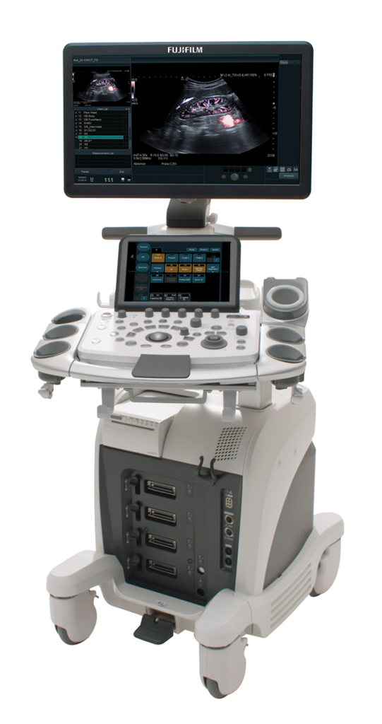 Radiology Ultrasound ARIETTA 65 Fujifilm Healthcare