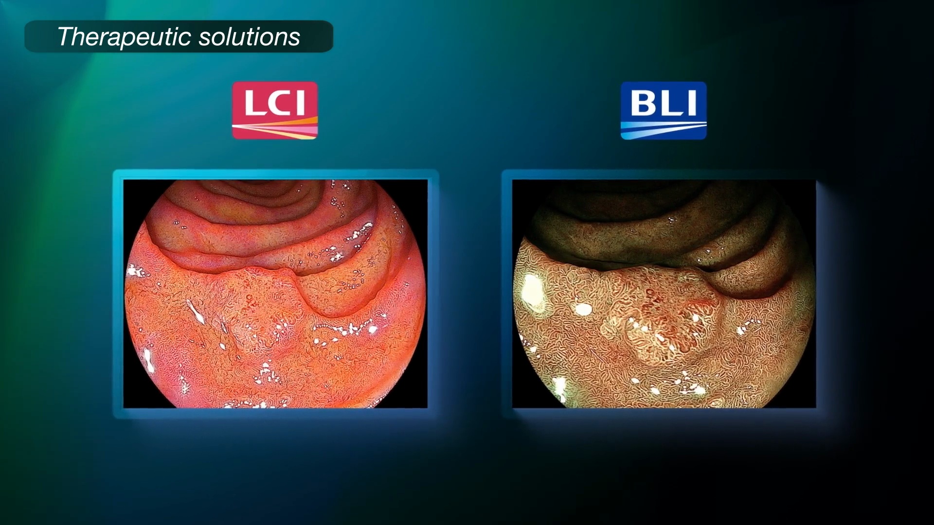 Interventional Gastro Video Imaging System | Fujifilim ELUXEO
