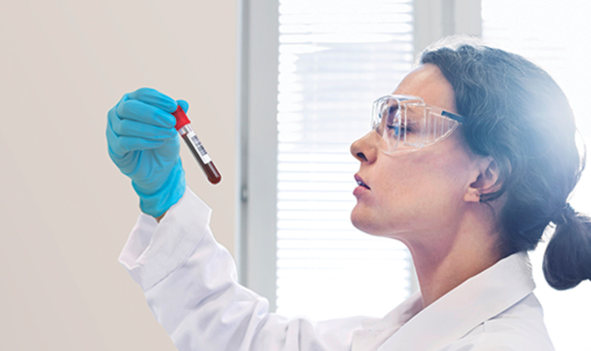 In Vitro Diagnostics